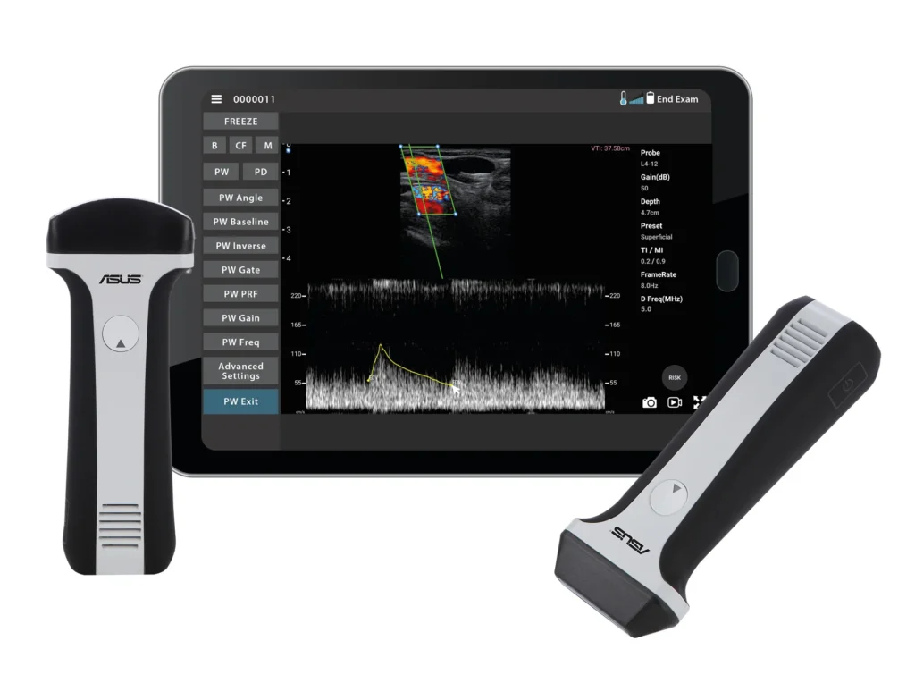 Requisiti hardware per sonde ecografiche wireless ASUS Dramiński